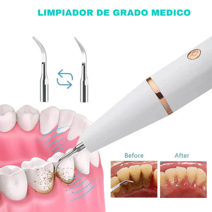 DentalClean ® : Quita Sarro + Cepillo dientes eléctrico - ¡ADIÓS AL DENTISTA! 😱